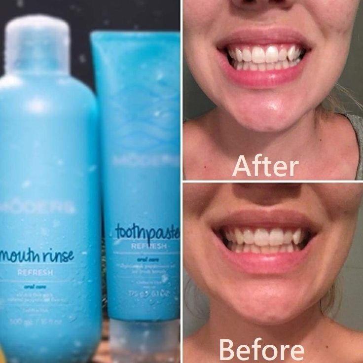 modere toothpaste fluoride free - Buy Modere NZ Products - Where to buy Modere New Zealand Shaklee Ambassador modere toothpaste fluoride free